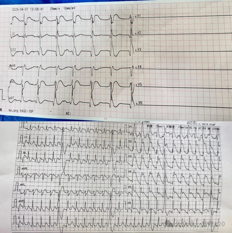 省緊急醫(yī)療救援中心成功挽救呼吸心跳驟停患者 省緊急醫(yī)療救援中心成功挽救呼吸心跳驟停患者