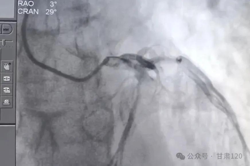 生死時速8分鐘——時間就是心肌 生死時速8分鐘——時間就是心肌